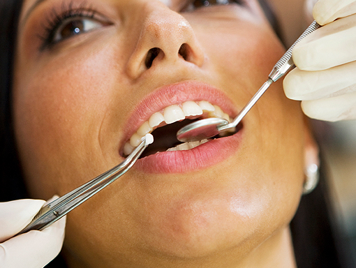 Clontarf Dental Practice - Extractions