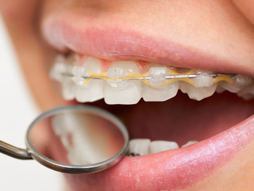 Clontarf Dental Practice - Orthodontic Referrals